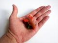 entoform transitus pinguis in hand 1